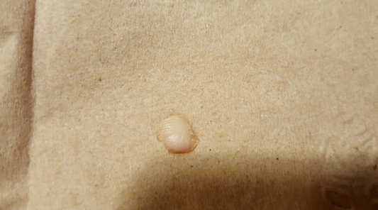 fingertip-found-in-the-salad-paso-robles-applebees